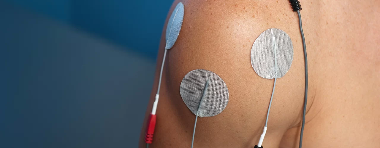 Electrical Stimulation - IMG Physical Therapy