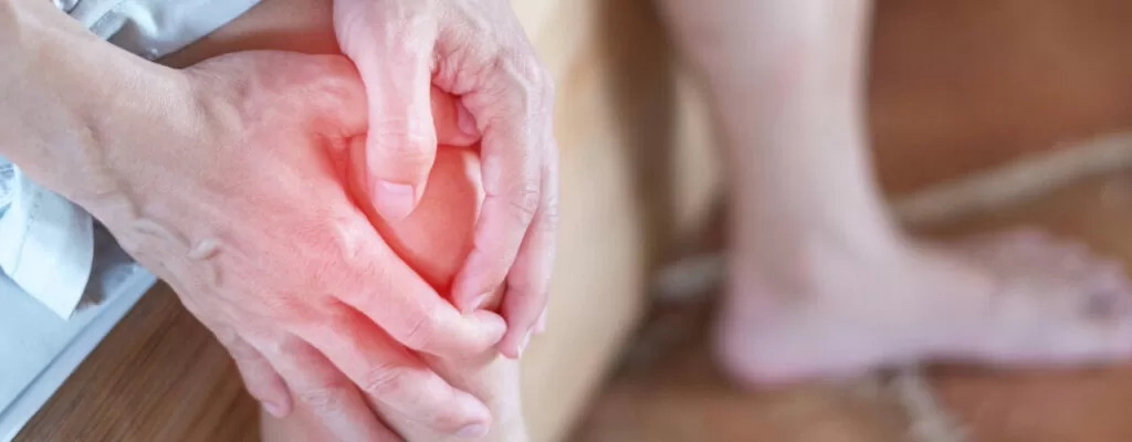 Arthritis