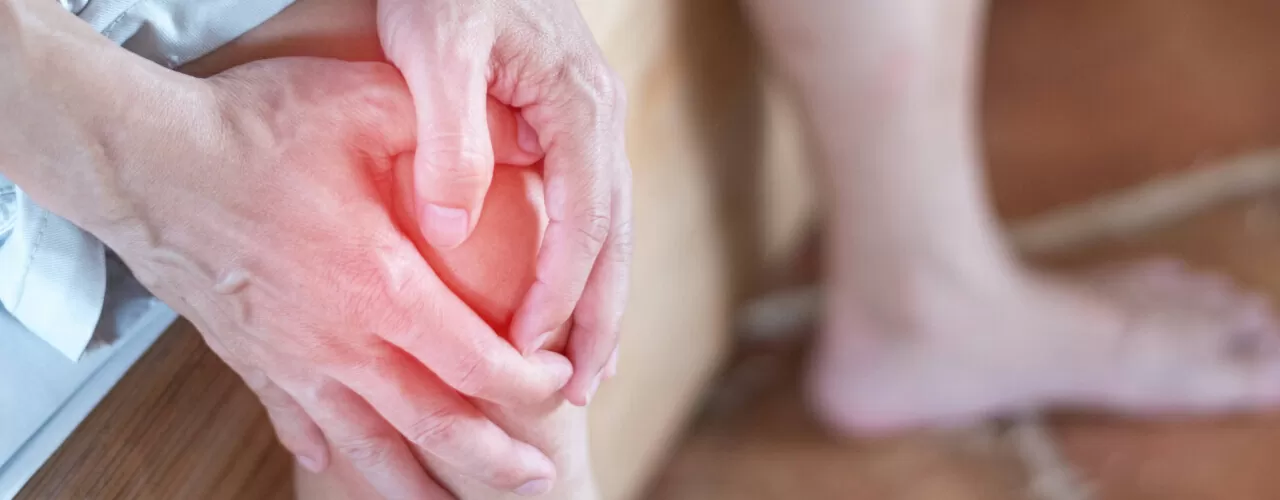 Arthritis